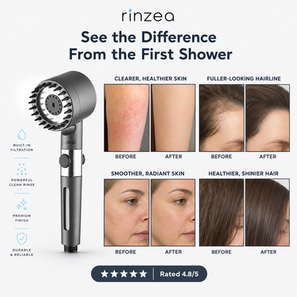 Rinzea Filtered Showerhead®